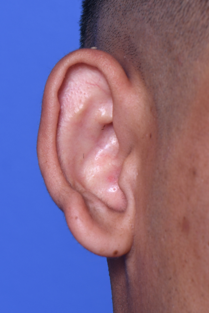 Before