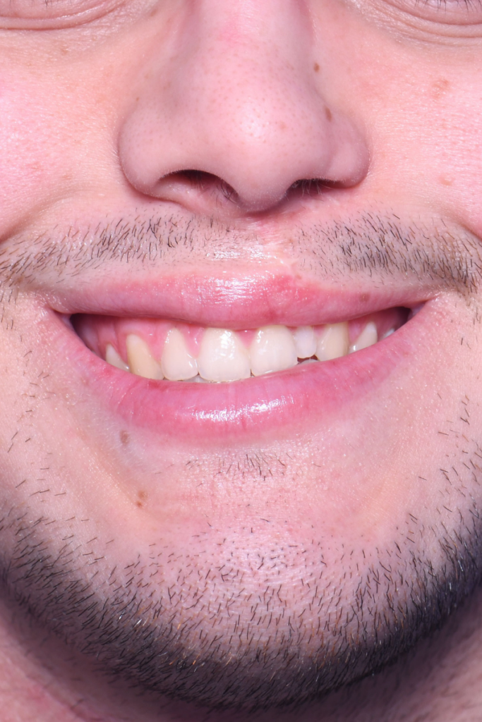 After