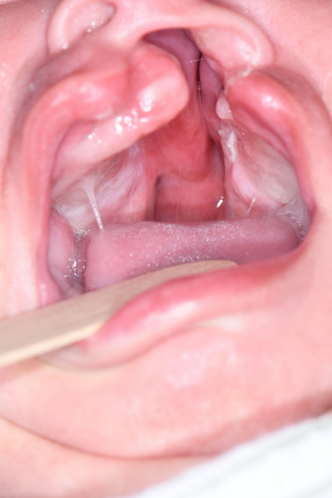 Before