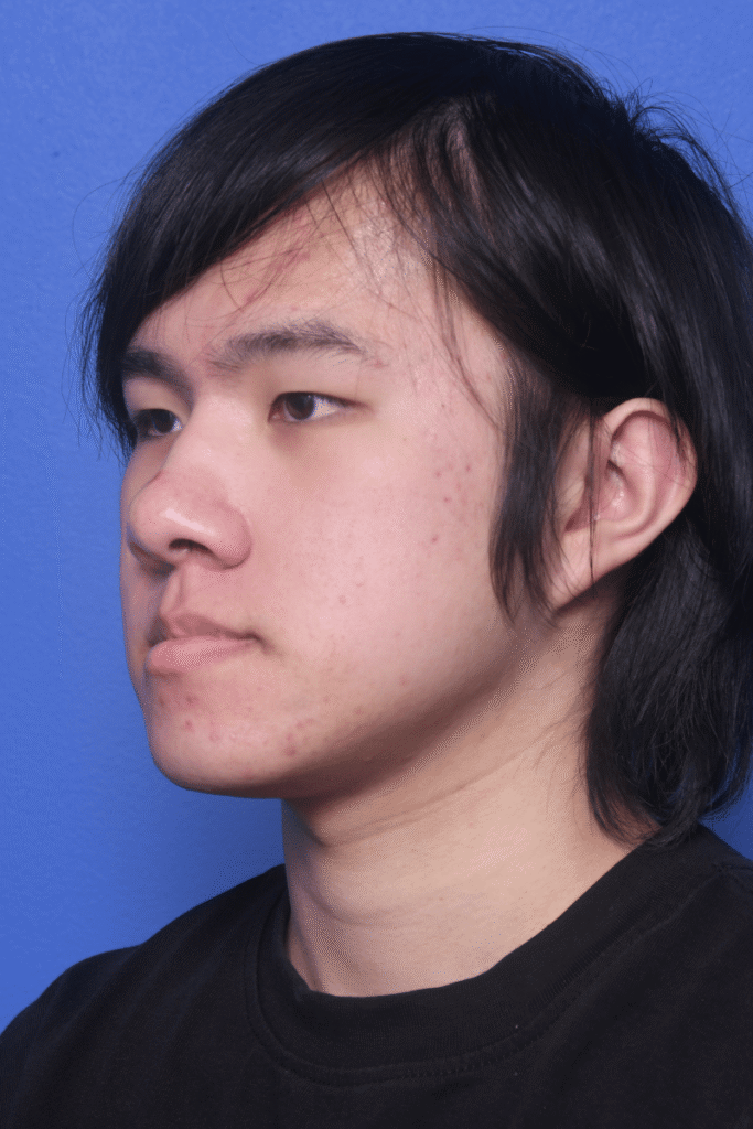 Before
