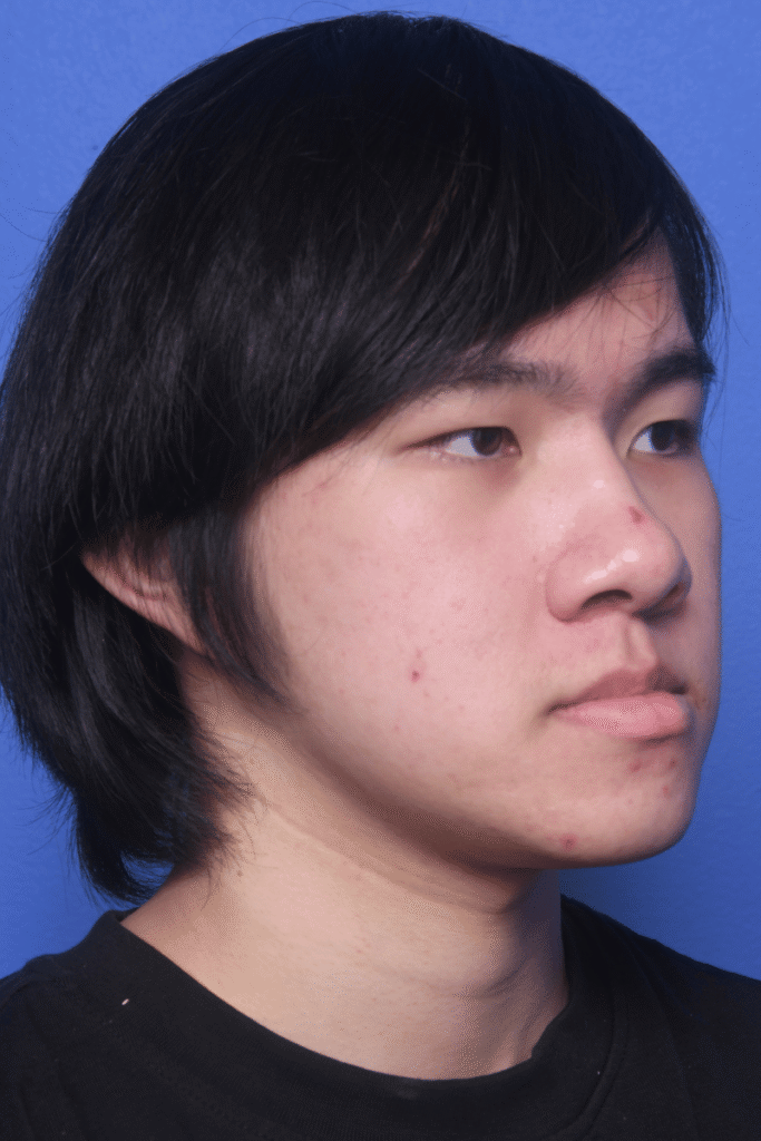 Before