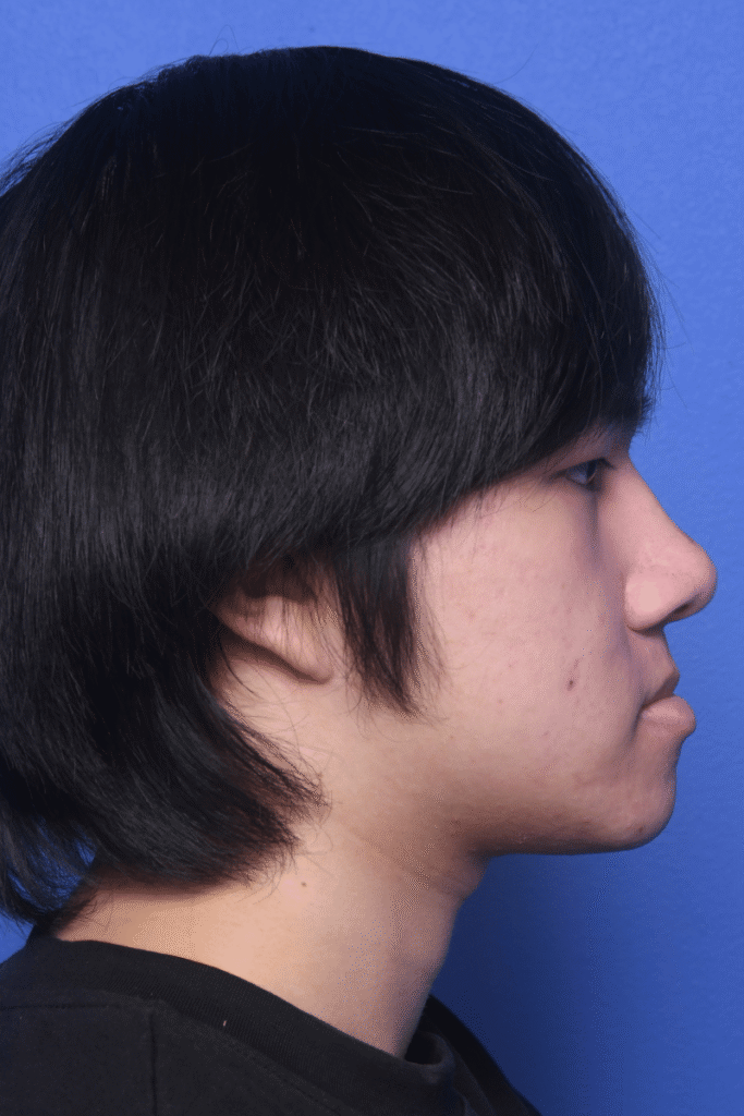Before